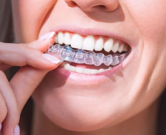 faq-invisalign-conforto